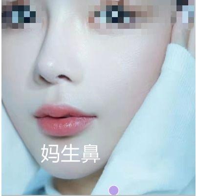 什么是网红鼻,流行趋势下的审美风向标